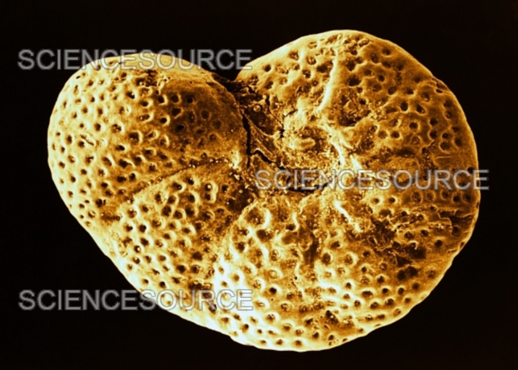 <i>Credit: Biophoto Associates / Science Source</i>