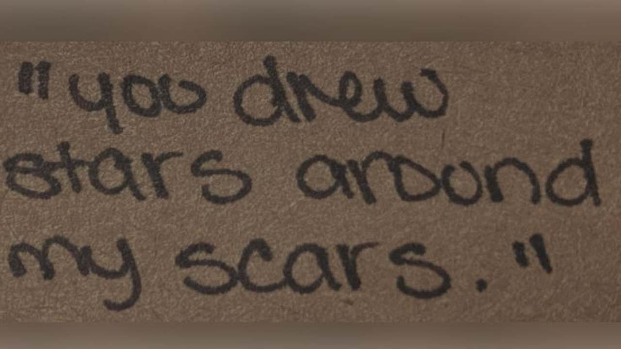 BUT NOW IT'S BLEEDING