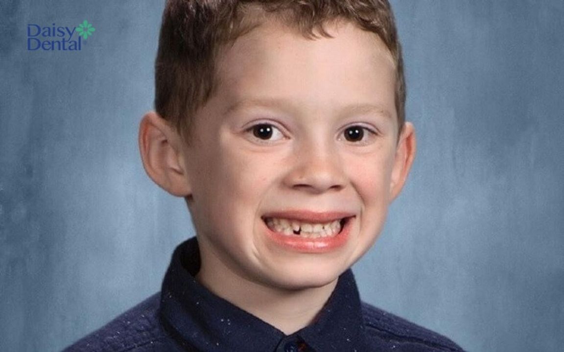 bạn cười như thế này thôi cũng trông đẹp trai xinh gái lắm đó nha ! ( nguồn ảnh: st )