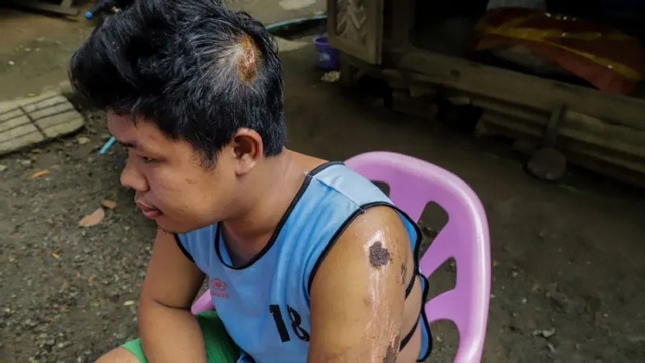 Yan Naing Myo bị thương trong vụ lở đất