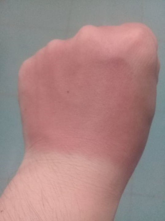 Làn da trắng như bông bưởi khiến bao cô gái thèm thuồng!