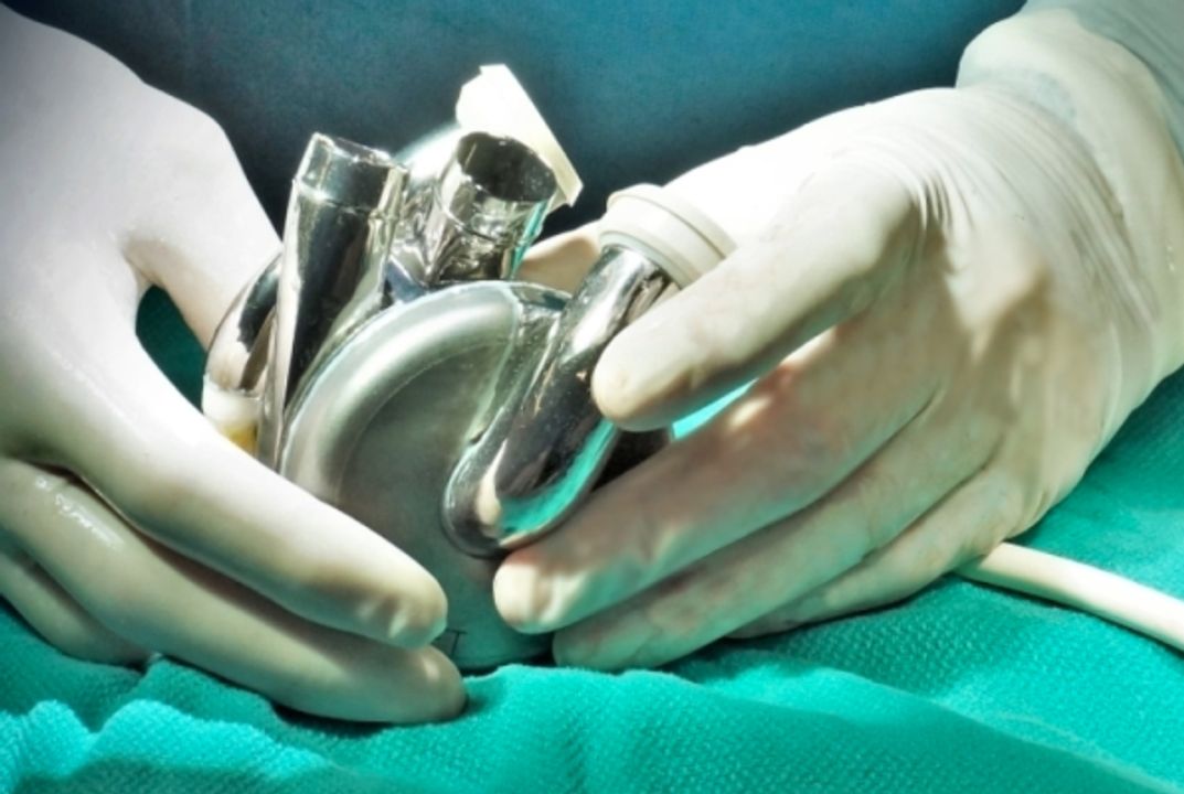 <a href="https://www.dicardiology.com/content/artificial-heart-receives-breakthrough-device-designation-fda" target="_blank">Artificial Heart Receives Breakthrough Device Designation from FDA | DAIC</a>
