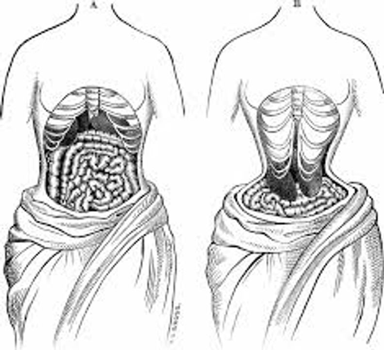 Việc mặc corset lâu dài có thể gây chèn ép nội tạng. Nguồn ảnh: Forbes