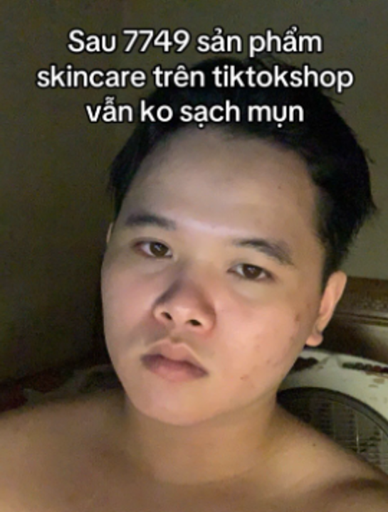 Vẫn không sạch mụn mặc dù da có mịn hơn......